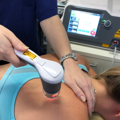 Womans rear shoulder being treated with laser