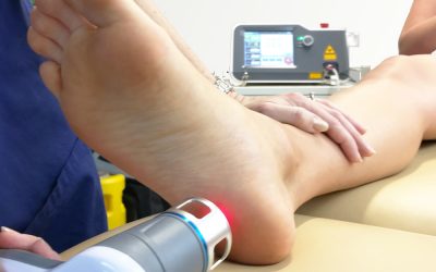 Laser Therapy For Plantar Fasciitis