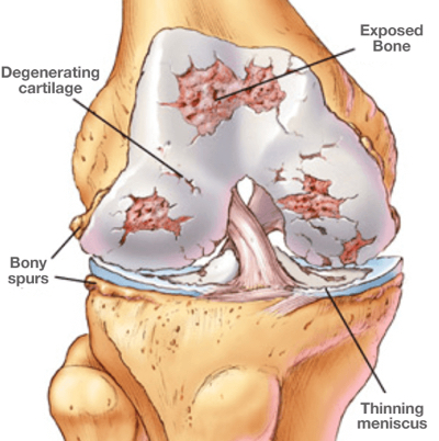 Cross section of knee